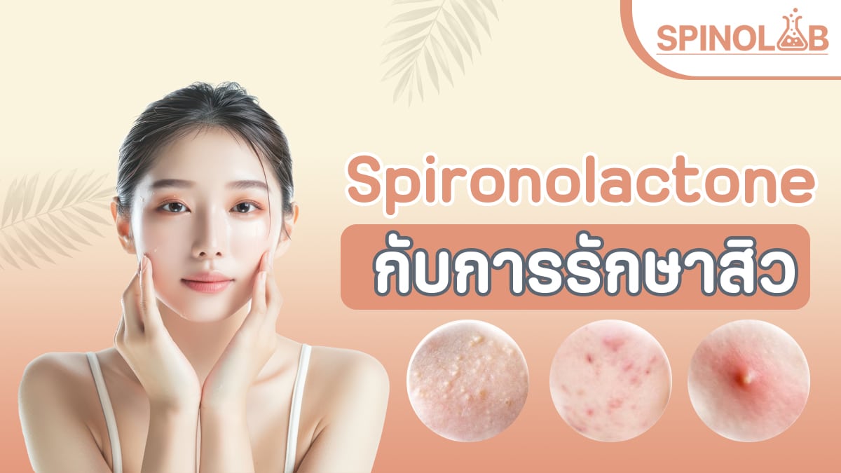 Spironolactone-กับการรักษาสิว